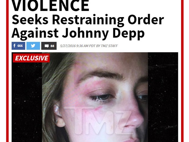 Site TMZ mostra imagem de Amber Heard com hematoma que teria sido provocado por seu marido, Johnny Depp, com um iPhone (Foto: Reprodução/TMZ) Site TMZ mostra imagem de Amber Heard com hematoma que teria sido provocado por seu marido, Johnny Depp, com um iPhone (Foto: Reprodução/TMZ)