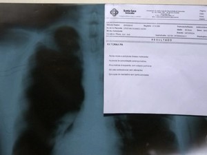 Morador de Sorocaba teve quatro cirurgias canceladas (Foto: Reprodução/TV TEM)