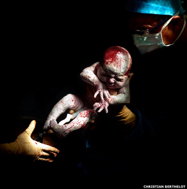 Louann, 12 de abril de 2013, 8h40, 3,574 quilos, 14 segundos depois do nascimen (Foto: Christian Berthelot) Louann, 12 de abril de 2013, 8h40, 3,574 quilos, 14 segundos depois do nascimen (Foto: Christian Berthelot)