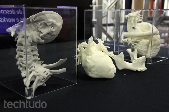 A empresa paulista 3DUX tem uma expectativa diferente da impressões 3D: criar réplicas perfeitas de tomografias para estudos pré-operatórios e aulas universitárias (Foto: Renato Bazan/TechTudo) A empresa paulista 3DUX tem uma expectativa diferente da impressões 3D: criar réplicas perfeitas de tomografias para estudos pré-operatórios e aulas universitárias (Foto: Renato Bazan/TechTudo)