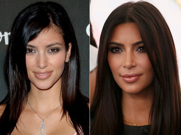 Kim Kardashian - ANTES e DEPOIS (Foto: Getty Images)