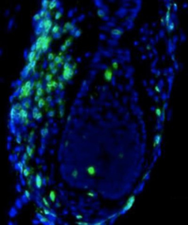  Imagem mostra um folículo capilar (azul) sendo atacado pelos linfócitos T (verde)  (Foto: Christiano Lab/Columbia University Medical Center/Divulgação)