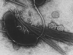 Imagem de microscópio mostra o vibrião colérico, bactéria causadora da cólera. (Foto: Tom Kirn, Ron Taylor, Louisa Howard/Dartmouth Electron Microscope Facility/Wikicommons)