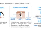 Saiba como evitar e o que fazer em caso de aftas, espinhas ou terçol