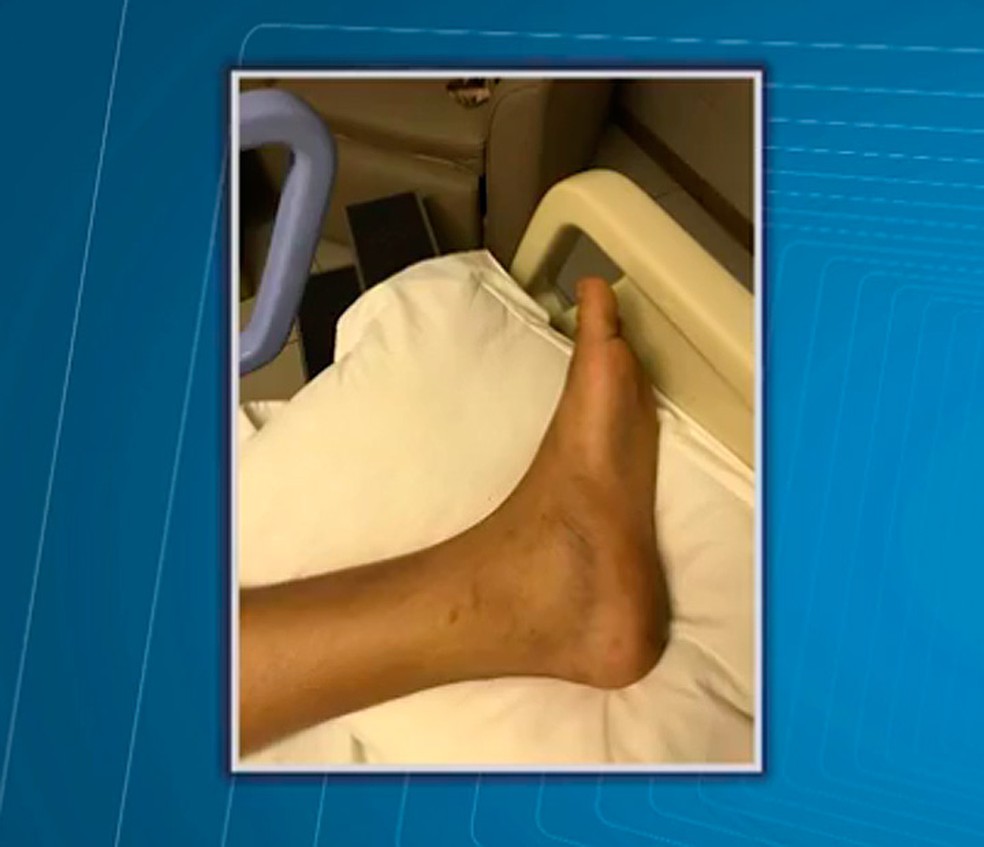 Iago Silva foi picado por uma cobra jararaca em uma festa eletrônica em Camaçari, na Bahia (Foto: Reprodução/ TV Bahia)