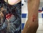 Brasuca do time de Zico sofre lesão na cabeça por causa de 'pegadinha'