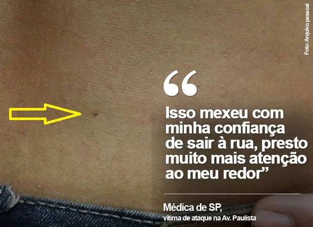 Médica foi agredida com agulhada quando andava perto da Av. Paulista, em SP (Foto: Arquivo pessoal)