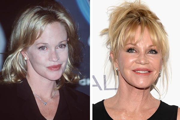 Melanie Griffith em 1998 e agora (Foto: Getty Images)