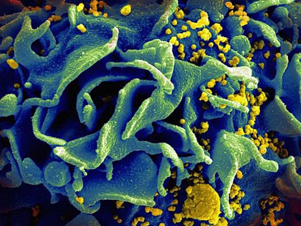 célula do sistema imune infectada por HIV (Foto: NIAID/NIH)