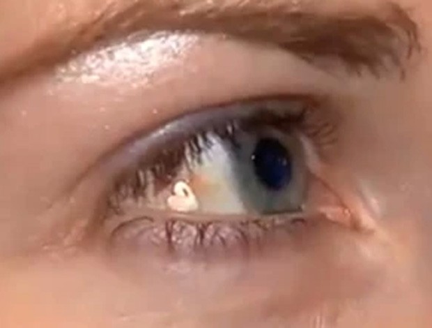Lucy Luckayanko implantou joia em um dos olhos para ter um 'diferencial'  (Foto: Reprodução/YouTube/StarNews)