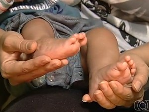 Adriel nasceu com má formação no pé direito e precisa de cirurgia (Foto: Reprodução/TV Anhanguera)