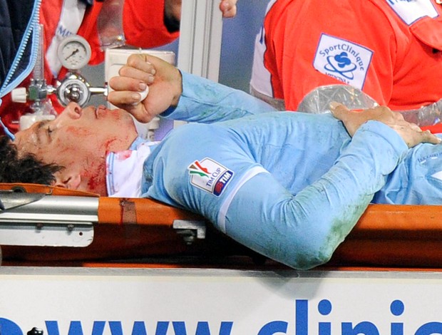 Hernanes Lazio (Foto: EFE)