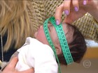 Saúde investiga morte de três bebês com microcefalia em Pernambuco 