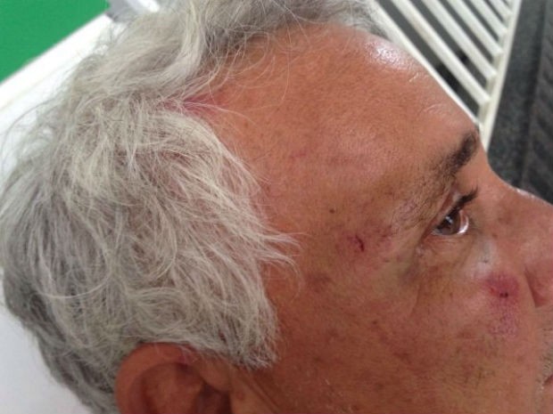 Idoso agredido por lutador de MMA, em Feira de Santana (Foto: Aldo Matos/Acorda Cidade)