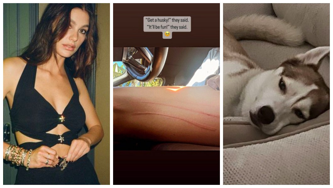 A modelo Camila Morrone mostrou os arranhões na perna feitos pelo cãozinho Jack (Foto: Instagram)