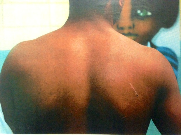 Jovem com marca de ferimento na unidade Guaianases da Fundação Casa (Foto: Reprdução/Defensoria Pública)
