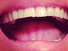 Ellen Jabour quebra o dente e posta foto: 'Quebrou um pedação'