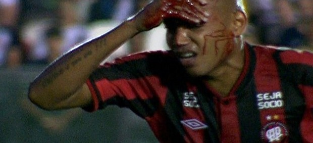 Luiz Alberto Atlético-PR corte na cabeça (Foto: reprodução Premiere FC)