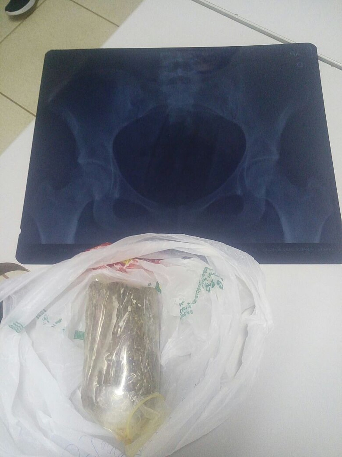 Jovem Presa Ao Tentar Entrar Em Pres Dio Drogas Na Vagina Em Ro Cacoal E Zona Da Mata G