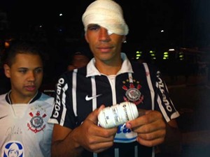 Fabiano Torquato foi um dos torcedores com ferimento mais grave: ele recebeu um tiro de bala de borracha na altura do olho (Foto: Rafael Sampaio/G1)