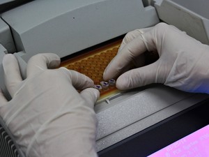 Exames para anemia