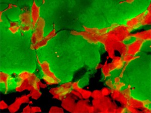 Em verde, células-tronco cancerígenas são infectadas com vírus e começam a morrer; células em vermelho não são cancerígenas e não foram infectadas (Foto: Divulgação/Instituto Paul Ehrlich)