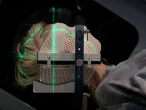 Hallenga fez radioterapia para tratar um tumor no cérebro (Foto: BBC/Reprodução)