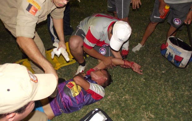 alemão, queimadense, segunda divisão, campeonato paraibano (Foto: Damião Lucena / Globoesporte.com/pb)