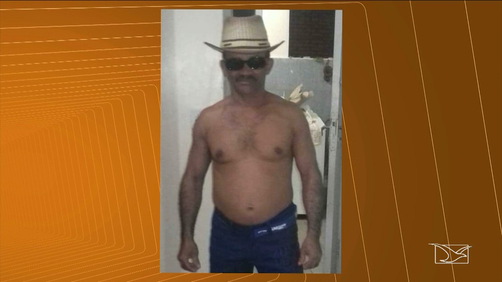 Raimundo Roberval Ferreira, de 46 anos, teve o corpo queimado após sofrer uma agressão no último domingo (11) no MA.  (Foto: Reprodução/TV Mirante)