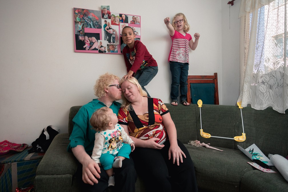 Família sem barreiras: Fernanda e Flávio têm duas filhas albinas e um moreno; na casa deles, todos são tratados com igualdade (Foto: Marcelo Brandt/G1)