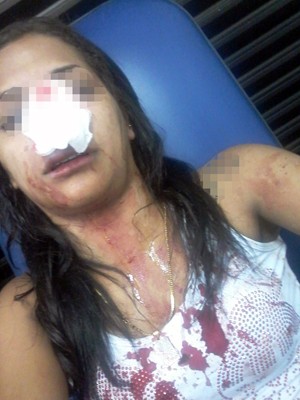 Jovem agredida durante assalto ficou com a roupa coberta de sangue (Foto: Arquivo Pessoal)