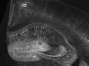  Imagem mostra clulas humanas embrionrias de rim; imagem foi feita com nova tcnica inspirada em tecnologia de fralda (Foto: AP Photo/Journal Science via AAAS )