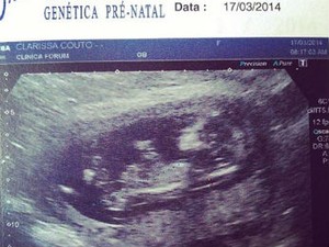 Foto mostra a ultra-sonografia realizada no dia 17 de março, quando o casal descobriu o sexo da criança  (Foto: Arquivo pessoal )
