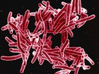 OMS diz que epidemia de tuberculose é mais grave do que se esperava