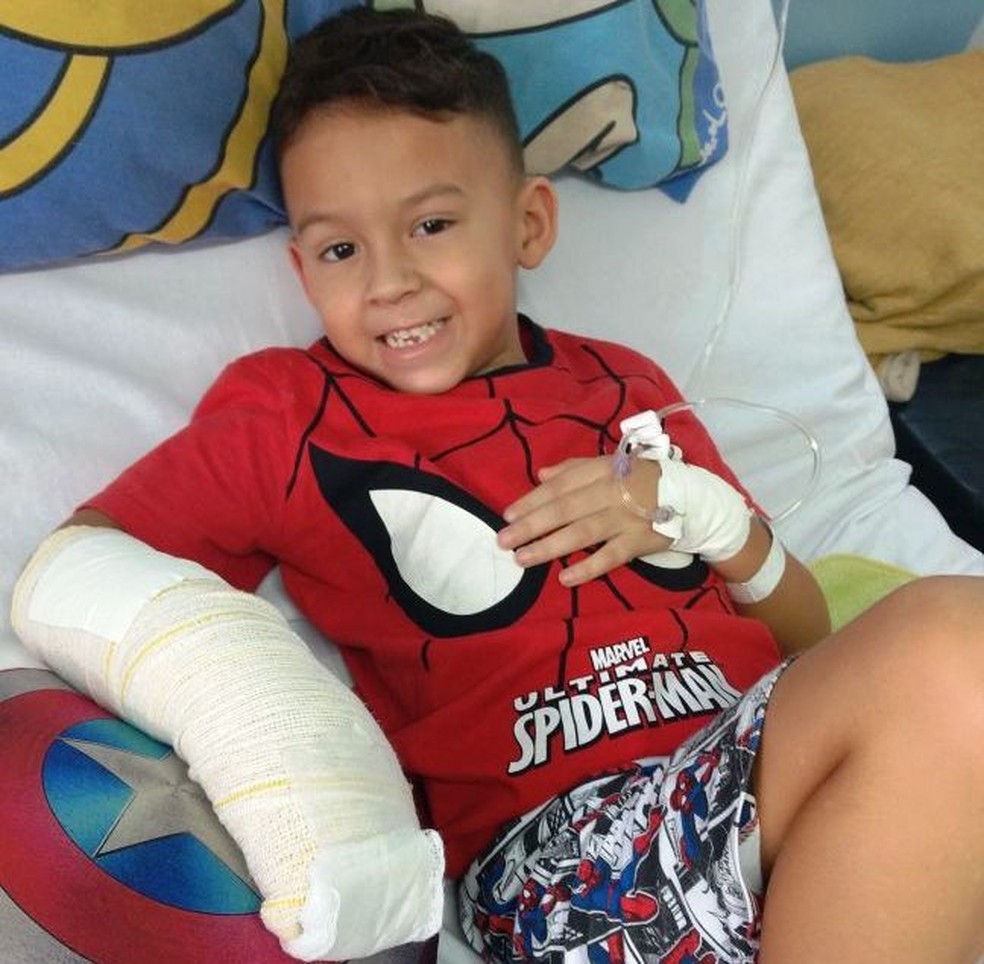 Caio, de 5 anos, teve dois dedos esmagados após queda de mesa (Foto: Arquivo Pessoal)