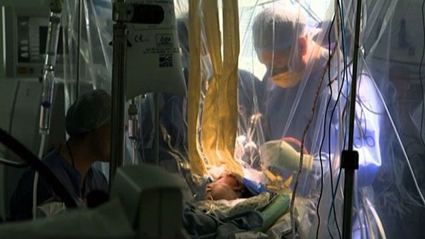 Paciente teve que ser acordada durante cirurgia para médicos verificarem se estavam causando danos em funções do cérebro (Foto: BBC)