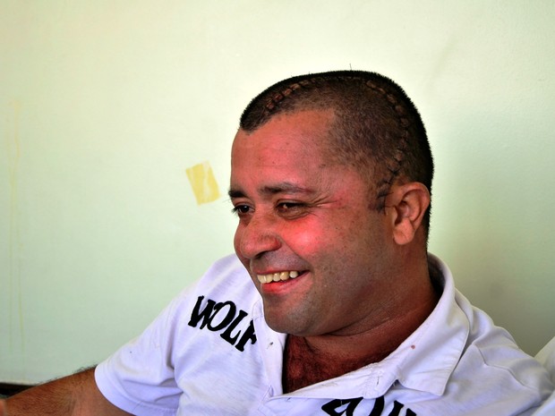 Homem passou por cirurgia de oito horas em Praia Grande, SP (Foto: Divulgação/Hospital Irmã Dulce)