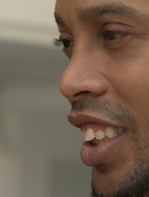 Ronaldinho Gaúcho sem o tampaão no olho  (Foto: Reprodução / TV Globo )