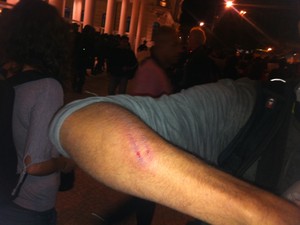 Fotógrafo foi ferido enquanto clicava um manifestante detido. Ele diz que foi acertado por um PM (Foto: Henrique Coelho/G1)