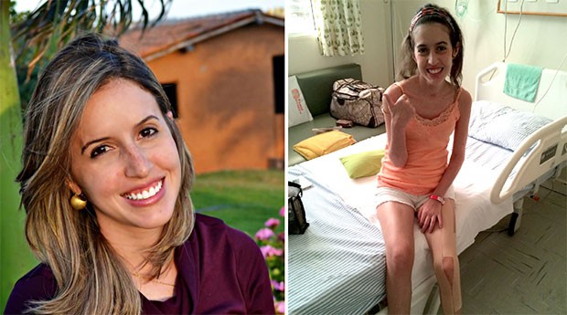 Hermilla Torres Pereira, antes e depois que começou a ter convulsões  (Foto: Hermilla Torres Pereira/Arquivo Pessoal)