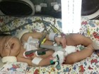 Morre bebê nascida em Bauru que aguardava cirurgia no coração em SP 