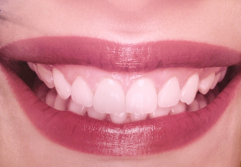  Estudo aponta que sorriso feito por duas universidades faz pessoas parecerem mais velhas  (Foto: Mariana Garcia/G1)