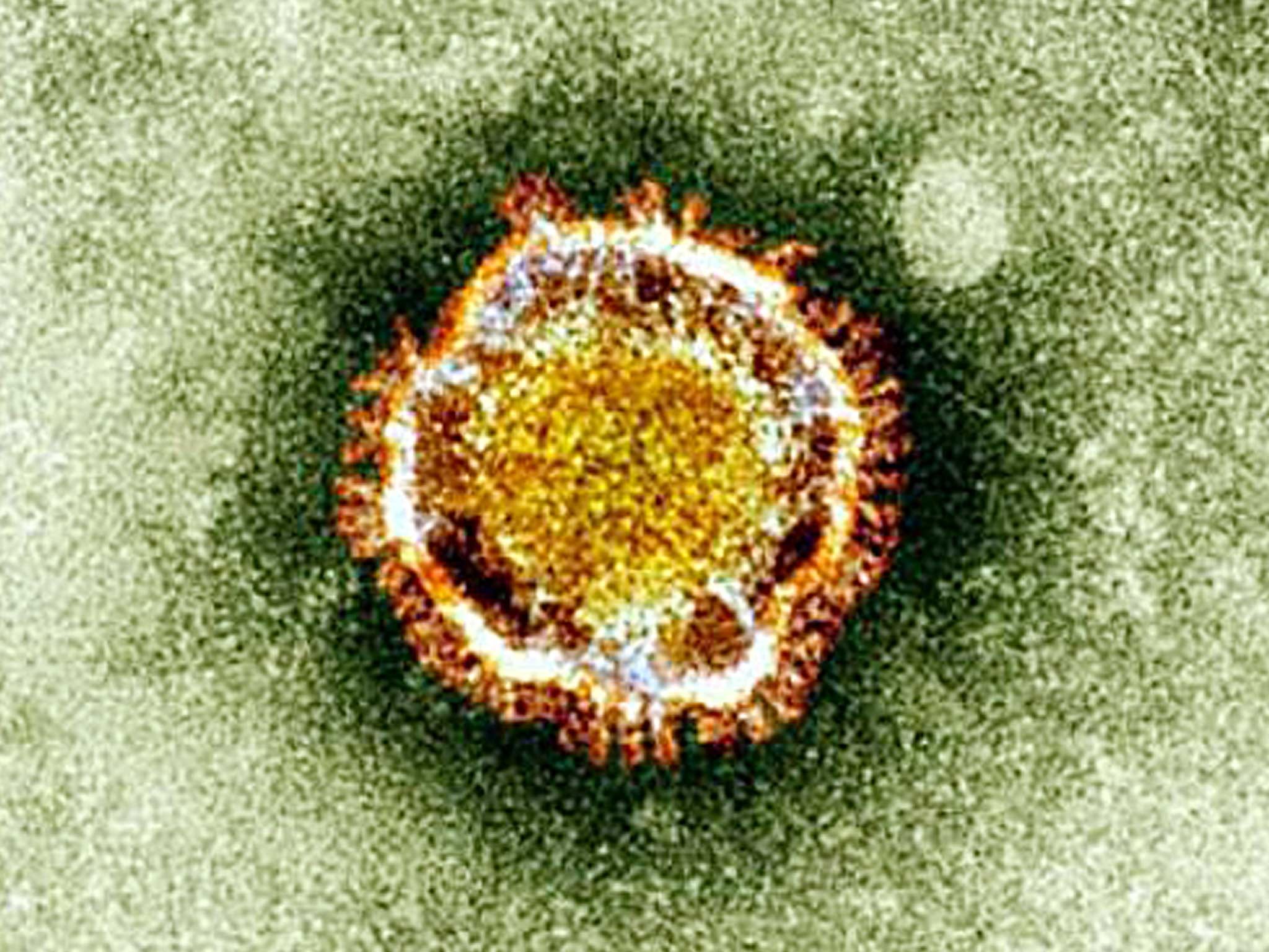 coronavirus (Foto: reprodução)