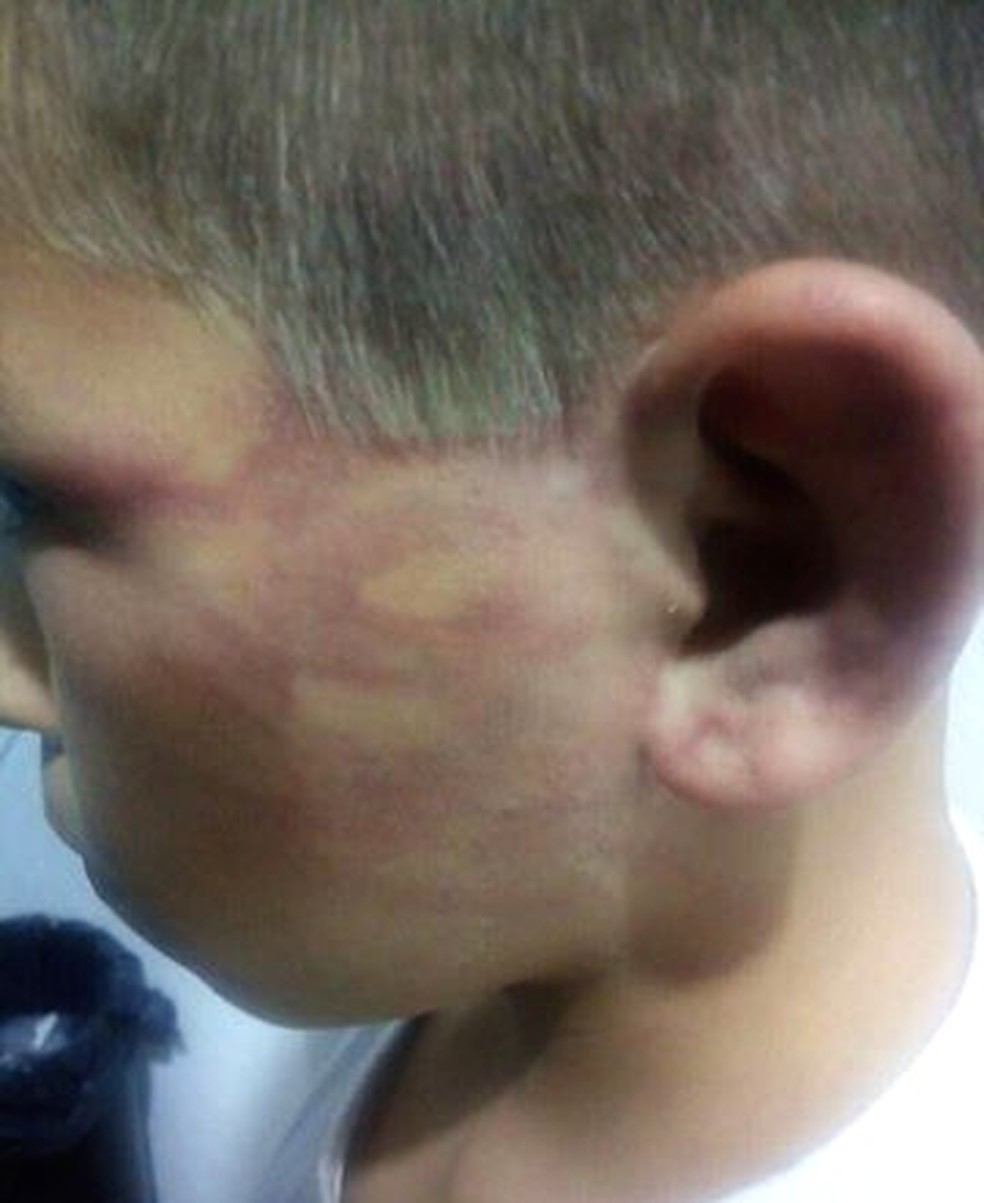 Criançou contou que era agredida com correntes, pedaço de madeira e uma pá de construção (Foto: Polícia Militar/Divulgação)