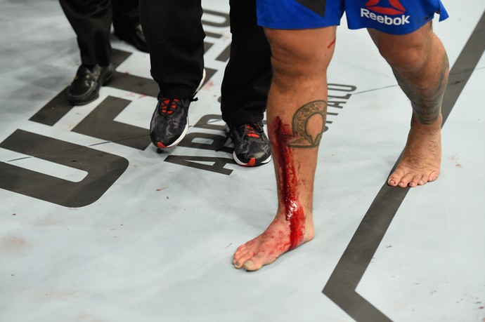 Perna Mark Hunt UFC 209 (Foto: Getty Images)