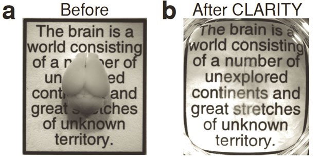 Imagem à esquerda mostra cérebro do rato; imagem à direita apresenta o cérebro no estágio transparente (Foto: Kwanghun Chung e Karl Deisseroth/Howard Hughes Medical Institute/Universidade Stanford)