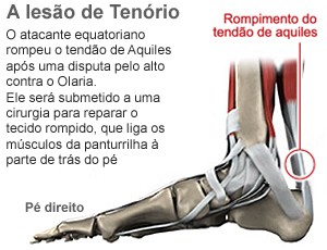 info lesão tendão de aquiles (Foto: arte Esporte)