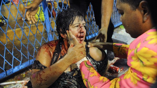Resultado de imagem para Acidente com carro alegórico no Rio faz 20 feridos