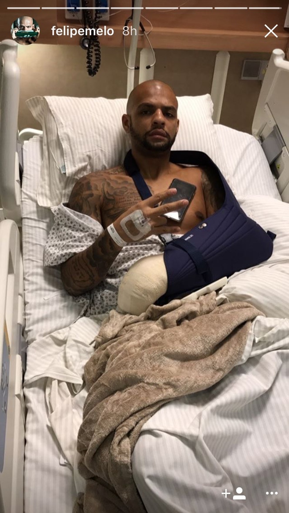Felipe Melo posa após cirurgia (Foto: Reprodução/Instagram)