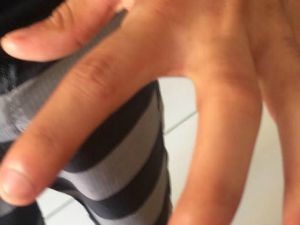 Gerente teria torcido o dedo de cliente após negar troco em Fortaleza (Foto: Arquivo Pessoal)
